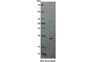 15% SDS-PAGE analysis of recombinant IL5Ra Protein. (IL5RA 蛋白)