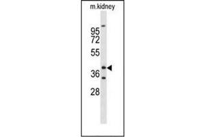 Western blot analysis ofFOXL1 / FKHL11 Antibody (Center) in mouse kidney tissue lysates (35ug/lane). (FOXL1 抗体  (Middle Region))