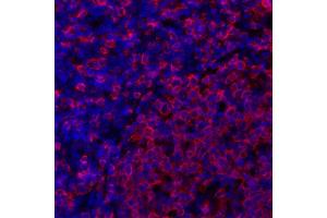 Immunofluorescence (IF) image for anti-HLA-DR (HLA-DR) antibody (ABIN7449537) (HLA-DR 抗体)