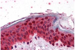 Human Skin: Formalin-Fixed, Paraffin-Embedded (FFPE) (HOXB7 抗体  (AA 55-121))