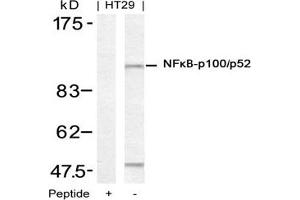 Image no. 3 for anti-Nuclear Factor of kappa Light Polypeptide Gene Enhancer in B-Cells 2 (NFKB2) (Ser871) antibody (ABIN197572) (NFKB2 抗体  (Ser871))