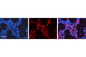 Rabbit Anti-TUBB2A Antibody Catalog Number: ARP40177_P050 Formalin Fixed Paraffin Embedded Tissue: Human Bone Marrow Tissue Observed Staining: Cytoplasm Primary Antibody Concentration: 1:100 Other Working Concentrations: 1:600 Secondary Antibody: Donkey anti-Rabbit-Cy3 Secondary Antibody Concentration: 1:200 Magnification: 20X Exposure Time: 0. (TUBB2A 抗体  (Middle Region))