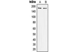 Western blot analysis of IRS1 expression in HeLa (A), HEK293 (B) whole cell lysates. (IRS1 抗体  (Center))