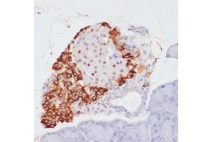 Immunohistochemistry (IHC) image for anti-ATP Citrate Lyase (ACLY) (pSer455) antibody (ABIN6136002)