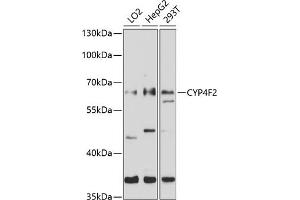 Western blot analysis of extracts of various cell lines, using CYP4F2 antibody (ABIN6130171, ABIN6139366, ABIN6139367 and ABIN6214266) at 1:1000 dilution. (CYP4F2 抗体  (AA 40-120))