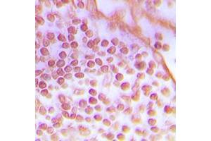 Immunohistochemical analysis of DNA-PKcs staining in human tonsil formalin fixed paraffin embedded tissue section. (PRKDC 抗体  (C-Term))