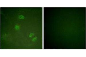 Immunofluorescence analysis of HeLa cells, using Elk3 (Ab-357) Antibody. (ELK3 抗体  (AA 323-372))