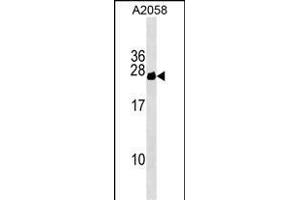 CYorf15B Antibody (Center) (ABIN1538521 and ABIN2849472) western blot analysis in  cell line lysates (35 μg/lane). (CYorf15B 抗体  (AA 60-86))