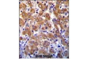 Immunohistochemistry (Paraffin-embedded Sections) (IHC (p)) image for anti-ATP-Binding Cassette, Sub-Family B (MDR/TAP), Member 10 (ABCB10) (AA 1-27), (N-Term) antibody (ABIN652180)