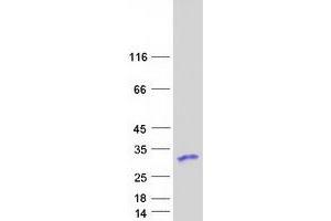 Ribosomal Protein S5 (RPS5) protein (Myc-DYKDDDDK Tag)