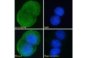 ABIN6391413 Immunofluorescence analysis of paraformaldehyde fixed MCF7 cells, permeabilized with 0. (PDGFB 抗体  (C-Term))