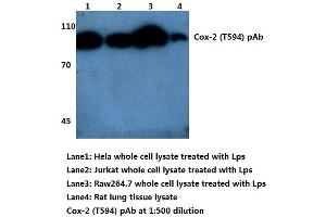 Western blot (WB) analysis of Cox2/PGHS2 (pThr594) antibody (PTGS2 抗体)