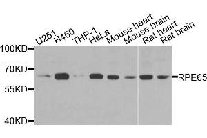 Western blot analysis of extracts of various cells, using RPE65 antibody. (RPE65 抗体)
