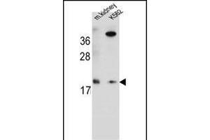 R Antibody (Center) (ABIN654772 and ABIN2844451) western blot analysis in mouse kidney tissue and K562 cell line lysates (35 μg/lane). (RNF185 抗体  (AA 88-117))
