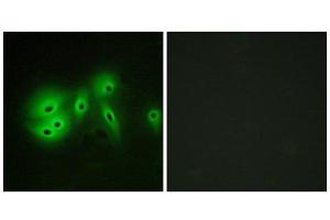 Immunofluorescence (IF) image for anti-Adenylate Cyclase 8 (Brain) (ADCY8) (Internal Region) antibody (ABIN1850180) (ADCY8 抗体  (Internal Region))