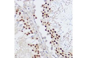 Immunohistochemistry of paraffin-embedded rat testis using KLF12 antibody (ABIN7268152) at dilution of 1:100 (40x lens). (KLF12 抗体)