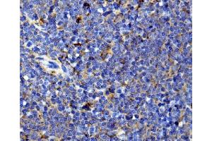 IHC analysis of Il13 using anti-Il13 antibody (ABIN7600672).