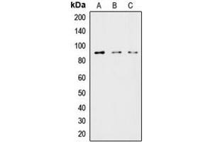Western blot analysis of HSL expression in HeLa (A), MCF7 (B), COLO205 (C) whole cell lysates. (LIPE 抗体  (Center))