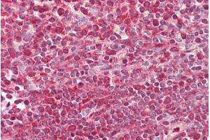 Immunohistochemistry with Spleen tissue at an antibody concentration of 5µg/ml using anti-EGR3 antibody (ARP38462_P050) (EGR3 抗体  (N-Term))