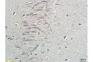 Formalin-fixed and paraffin embedded rat brain labeled with Anti-HRG BETA1, Unconjugated (ABIN734873) followed by conjugation to the secondary antibody and DAB staining (Neuregulin 1 抗体  (AA 221-320))