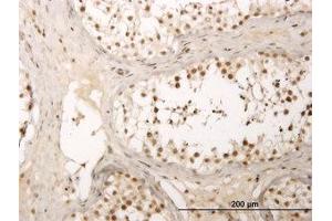 Image no. 1 for anti-Zinc Finger Protein 213 (ZNF213) (AA 133-243) antibody (ABIN599017) (ZNF213 抗体  (AA 133-243))