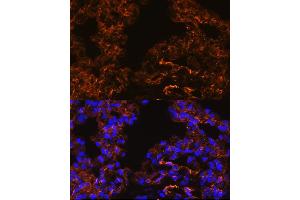Immunofluorescence analysis of Rat lung cells using Caveolin-1 antibody (ABIN6131271, ABIN6137992, ABIN6137993 and ABIN6218615) at dilution of 1:100. (Caveolin-1 抗体  (AA 1-100))