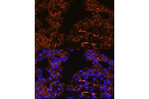 Immunofluorescence analysis of Rat lung cells using Caveolin-1 antibody (ABIN6131271, ABIN6137992, ABIN6137993 and ABIN6218615) at dilution of 1:100. (Caveolin-1 抗体  (AA 1-100))