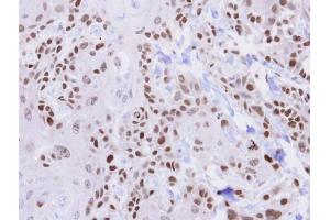 Immunohistochemistry (IHC) image for anti-HUS1 Checkpoint Homolog (S. Pombe) (HUS1) (Center) antibody (ABIN2856928)