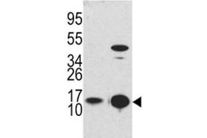 Western Blotting (WB) image for anti-Microtubule-Associated Protein 1 Light Chain 3 beta (MAP1LC3B) (AA 1-30) antibody (ABIN3031789)