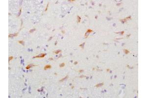 Formalin-fixed and paraffin embedded rat brain labeled with Anti-GGA2 Polyclonal Antibody, Unconjugated  at 1:200 followed by conjugation to the secondary antibody and DAB staining (GGA2 抗体  (AA 161-260))