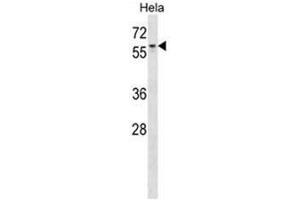 AGFG1 Antibody (N-term) western blot analysis in Hela cell line lysates (35 µg/lane). (AGFG1 抗体  (N-Term))
