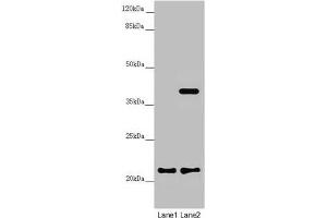 Western blot All lanes: DCTN6 antibody at 3. (DCTN6 抗体  (AA 1-190))