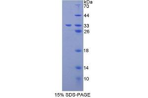 SDS-PAGE analysis of Mouse GLVR1 Protein. (SLC20A1 蛋白)