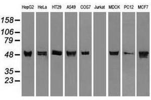 Image no. 3 for anti-Keratin 8 (KRT8) (AA 91-381) antibody (ABIN1491713) (KRT8 抗体  (AA 91-381))