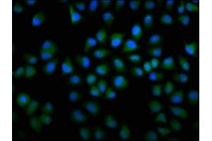 Immunofluorescence staining of Hela cells with ABIN7148001 at 1:166, counter-stained with DAPI. (F13A1 抗体  (AA 380-520))