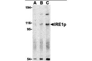 Western Blotting (WB) image for anti-Endoplasmic Reticulum To Nucleus Signaling 1 (ERN1) (N-Term) antibody (ABIN1031419) (ERN1 抗体  (N-Term))
