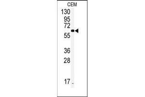 Western blot analysis of anti-CYP2J2 Antibody (Center) in CEM cell line lysates (35ug/lane). (CYP2J2 抗体  (Middle Region))