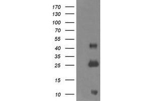Western Blotting (WB) image for anti-Aldehyde Dehydrogenase 1 Family, Member A3 (ALDH1A3) (AA 1-100), (AA 413-512) antibody (ABIN1490536) (ALDH1A3 抗体  (AA 1-100, AA 413-512))