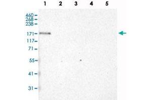 Western Blot analysis of recombinant protein Lane 1: Laminin-332, Lane 2: Laminin-421, Lane 3: Laminin-511, Lane 4: Laminin-121 and Lane 5: Laminin-221 with LAMA3 monoclonal antibody, clone CL3112 . (LAMA3 抗体)