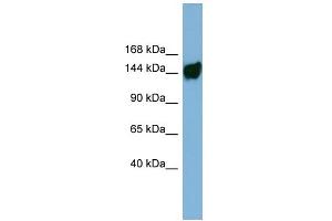 WB Suggested Anti-AASDH Antibody Titration: 0. (AASDH 抗体  (Middle Region))