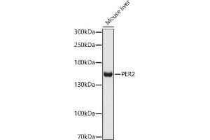 Western blot analysis of extracts of Mouse liver, using PER2 antibody (ABIN6131889, ABIN6145450, ABIN6145452 and ABIN6217063) at 1:1000 dilution. (PER2 抗体  (AA 1-150))