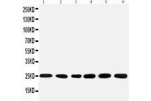 Anti-SNRPN antibody, Western blotting Lane 1: Rat kidney Tissue Lysate Lane 2: U87 Cell Lysate Lane 3: U87 Cell Lysate Lane 4: HELA Cell Lysate Lane 5: HMY Cell Lysate Lane 6: NEUR Cell Lysate (SNRPN 抗体  (N-Term))