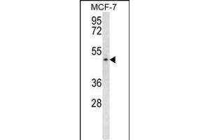 SCD5 Antibody (Center) (ABIN656967 and ABIN2846151) western blot analysis in MCF-7 cell line lysates (35 μg/lane). (SCD5 抗体  (AA 147-175))