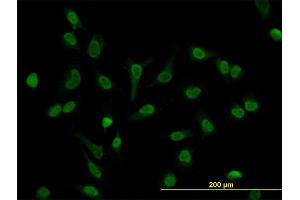 Immunofluorescence of monoclonal antibody to LEF1 on HeLa cell. (LEF1 抗体  (AA 14-123))