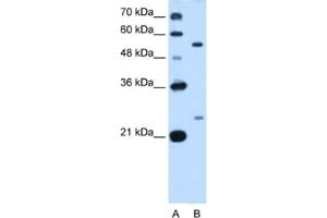 Western Blotting (WB) image for anti-LOC642486 (LOC642486) antibody (ABIN2462914) (LOC642486 抗体)
