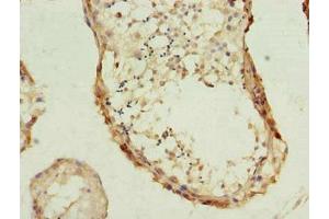 Immunohistochemistry of paraffin-embedded human testis tissue using ABIN7163042 at dilution of 1:100 (PHF1 抗体  (AA 151-360))