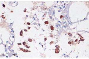 Immunohistochemistry of paraffin-embedded Human lung using CD68 Polyclonal Antibody at dilution of 1:100 (40x lens). (CD68 抗体)