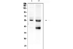 anti-Transforming Growth Factor, beta Receptor 1 (TGFBR1) (AA 149-186), (N-Term) antibody