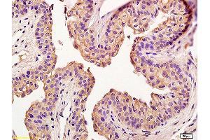 Formalin-fixed and paraffin embedded rat penile labeled with Anti-Claudin 5 Polyclonal Antibody, Unconjugated (ABIN673869) at 1:200 followed by conjugation to the secondary antibody and DAB staining (Claudin 5 抗体)