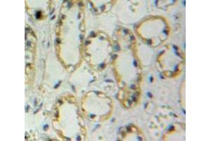 IHC-P analysis of Kidney tissue, with DAB staining. (Nephrin 抗体  (AA 39-106))